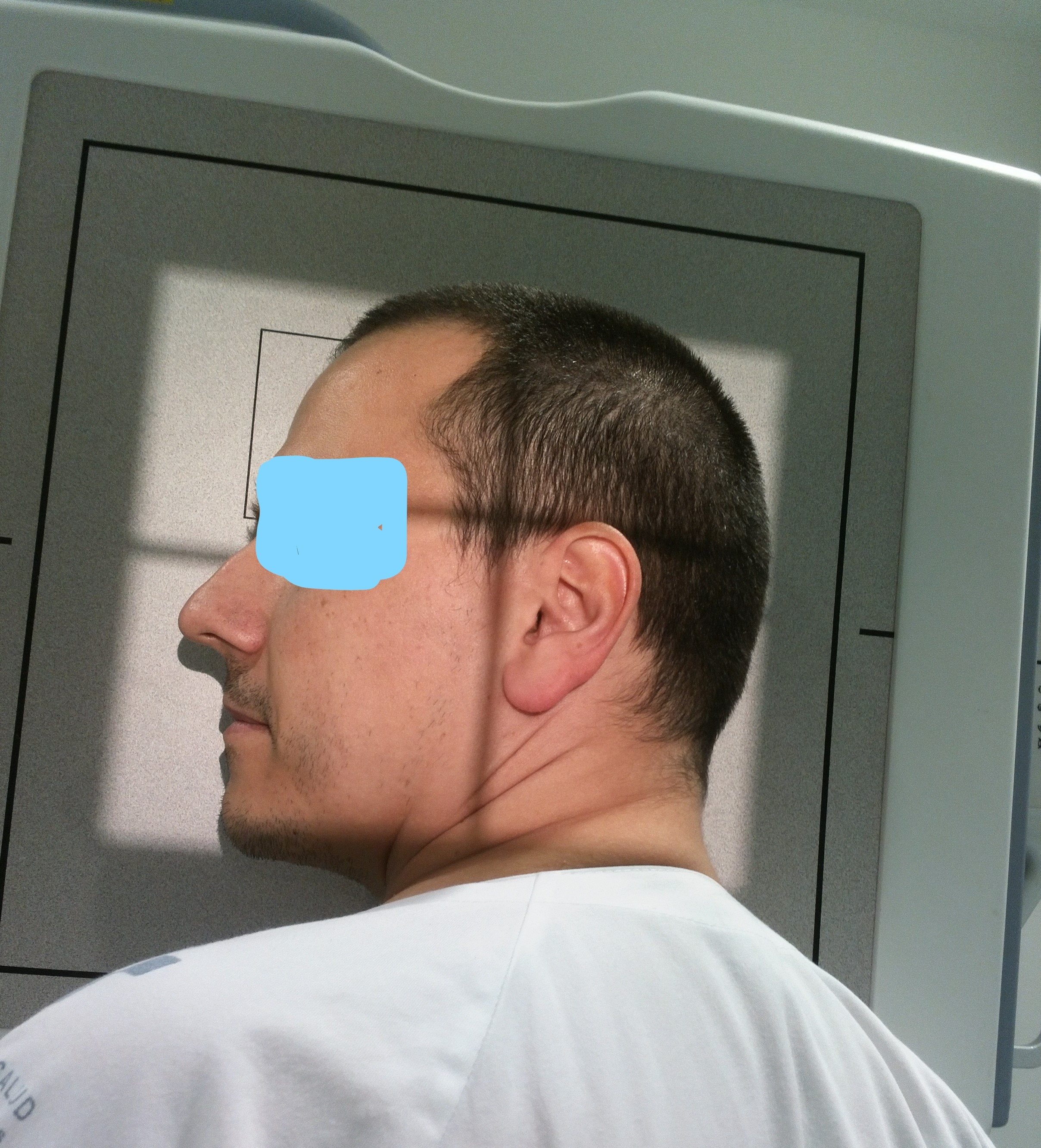 Posicionamiento Lateral Cráneo